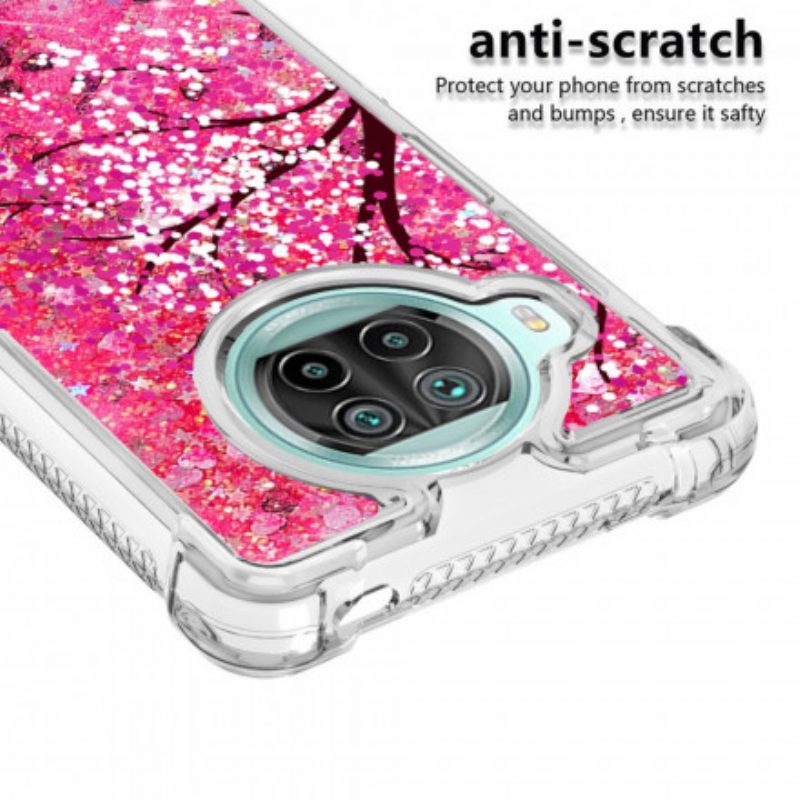 Hoesje voor Xiaomi Mi 10T Lite Glitter Boom